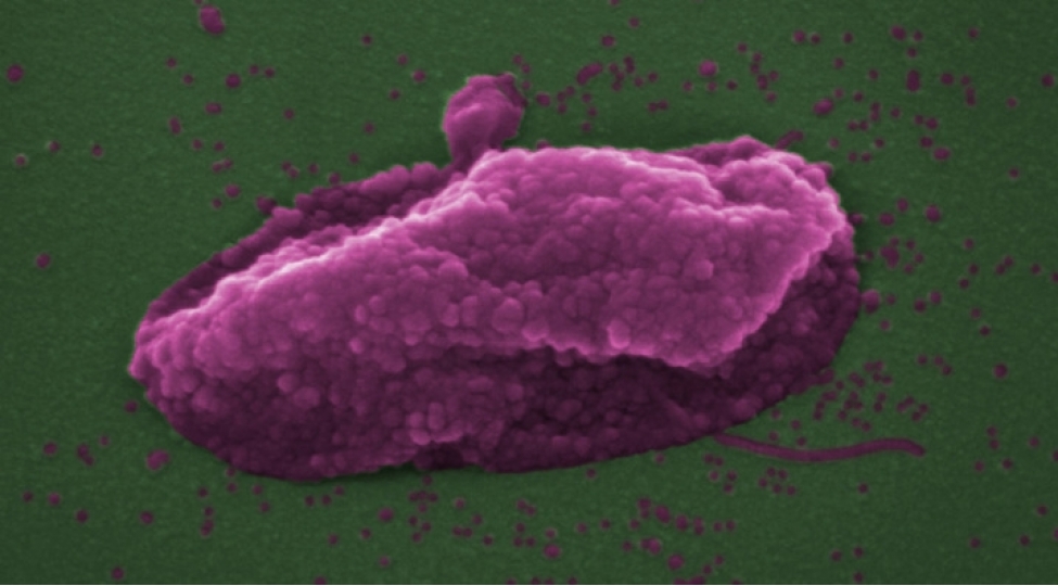 son-chare-olan-antibiotik-elm-adamlari-kolistinin-effektivliyinin-sirrini-keshf-etdiler