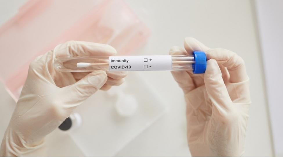 son-sutkada-azerbaycanda-64-nefer-koronavirusa-yoluxub-foto