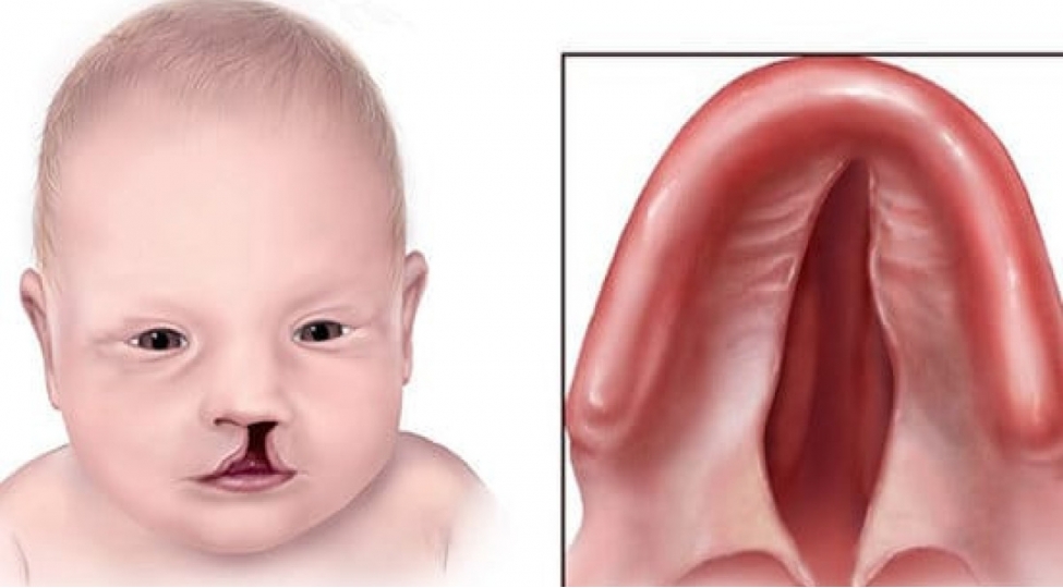 bu-ushaqlar-17-18-yashina-qeder-hekim-nezareti-altinda-olmalidir