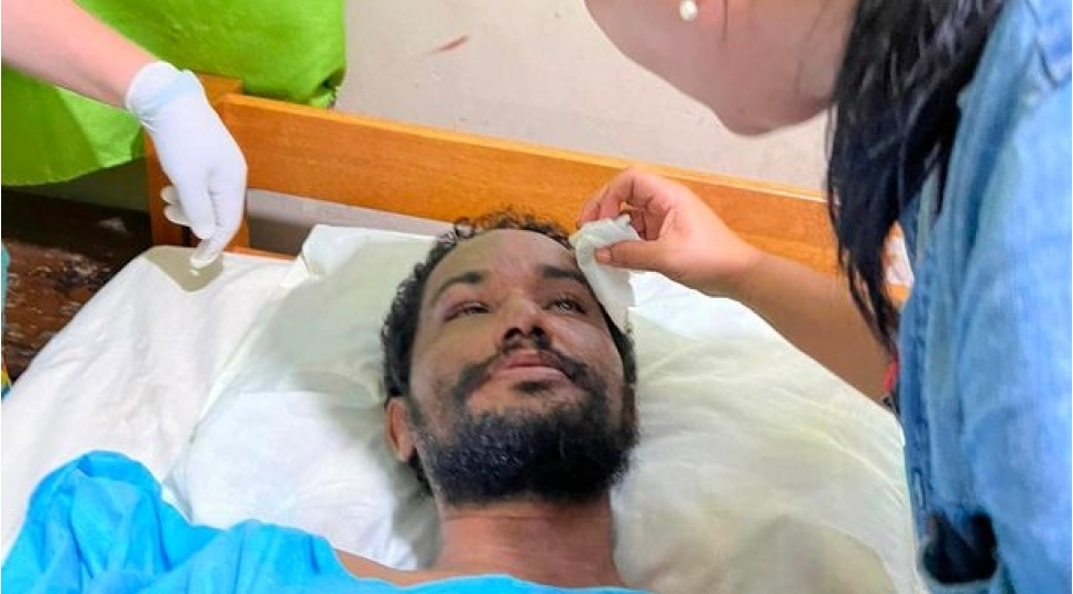 meshede-soxulcan-yeyerek-sag-qaldi-foto