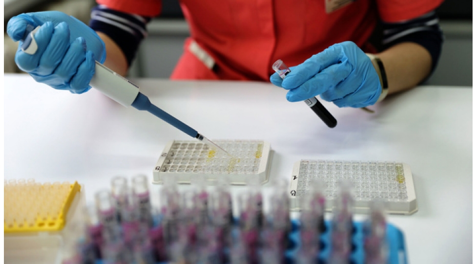 yoluxucudur-ve-peyvendden-qorxmur-covid-19-un-arcturus-shtammi-haqqinda-bashqa-neler-melumdur