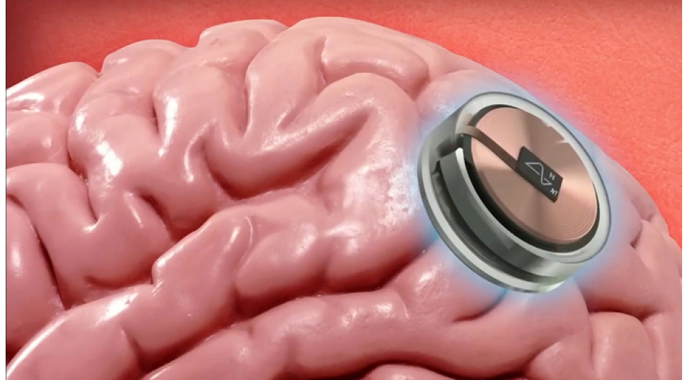 ilon-mask-indi-bashimiza-ne-bela-achmaq-isteyir