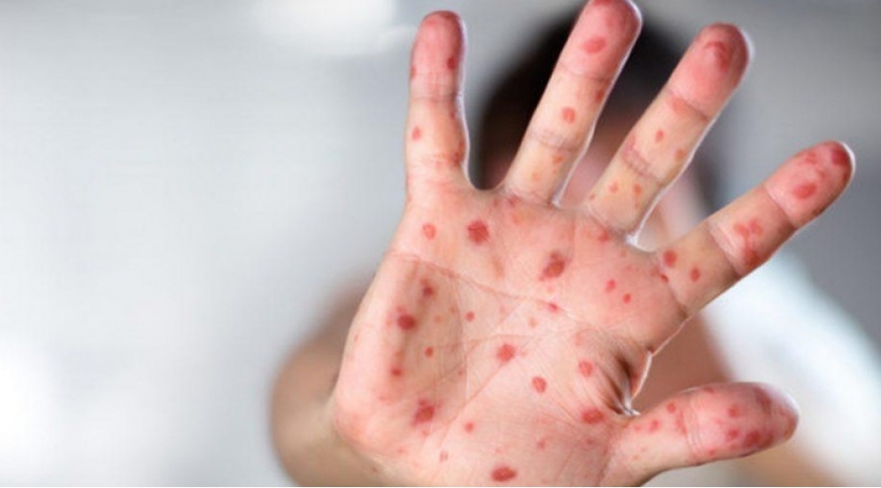 azerbaycanda-10-nefer-qizilcaya-yoluxub