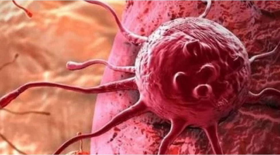 qidani-xerchenge-cheviren-esas-sehv-achiqlandi