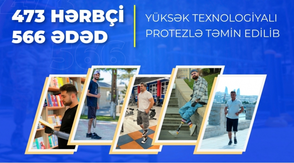 veten-muharibesinden-sonra-473-herbchi-566-eded-yuksek-texnologiyali-protezle-temin-edilib