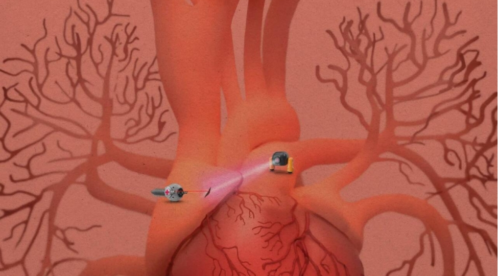 robot-agrikesiciler-hazirlandi