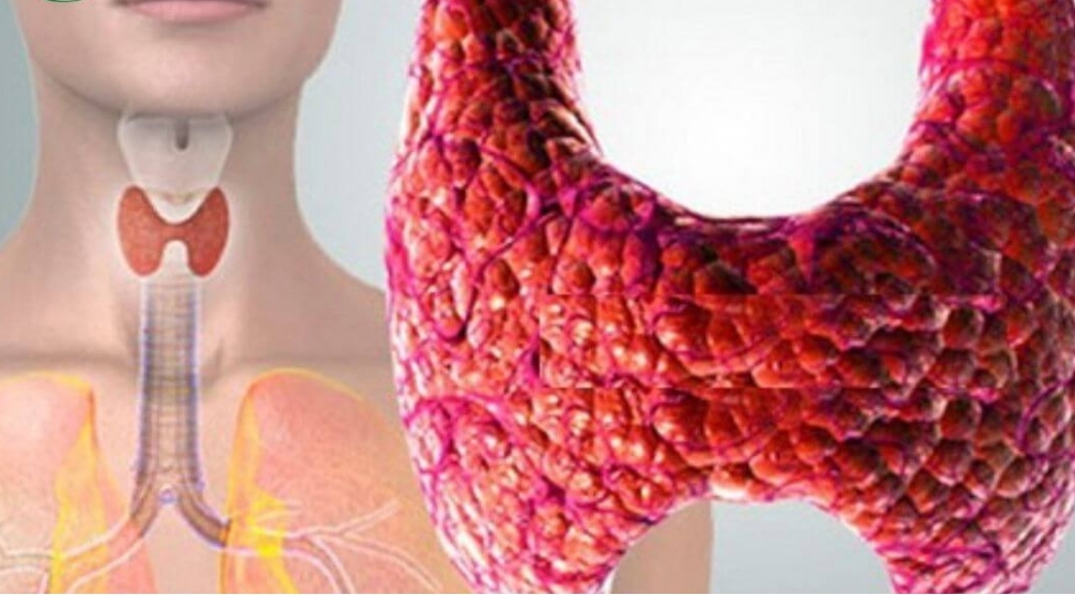 zob-ozunu-bele-gosterir