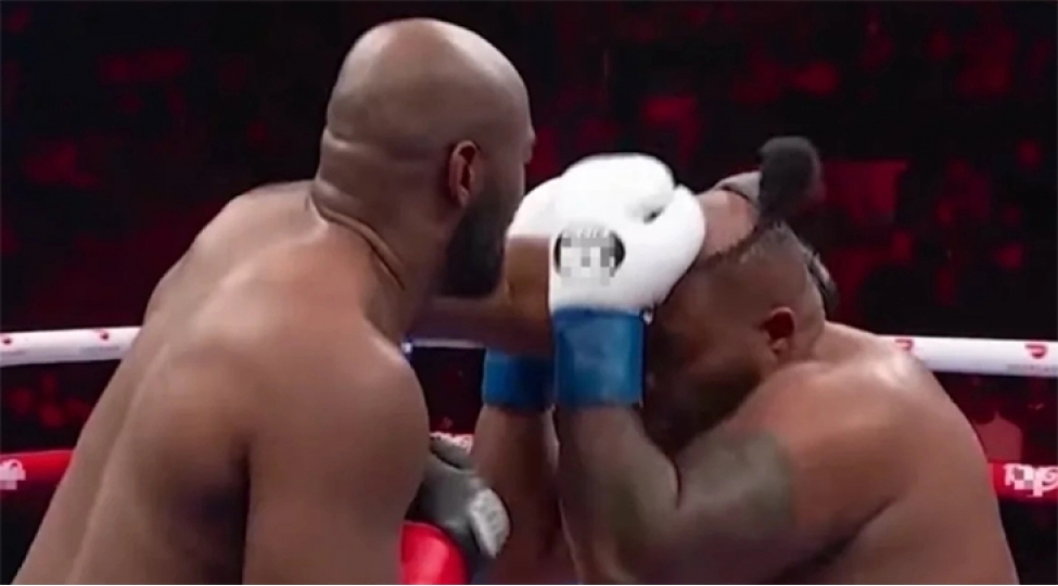 amerikali-bokschu-zerbeleri-ile-reqibinin-parikini-qopardi