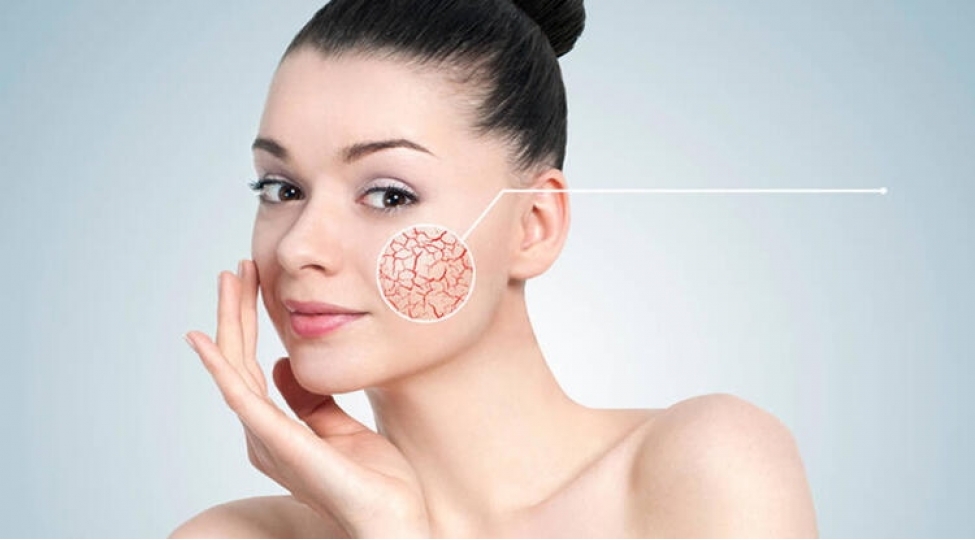 shushe-kimi-deri-effekti-nece-elde-olunur