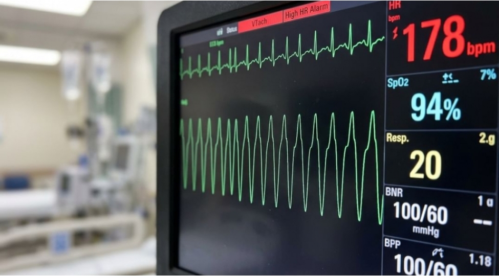 aritmiyanin-mualicesinde-yeni-merhele-vyana-alimlerinin-keshfi